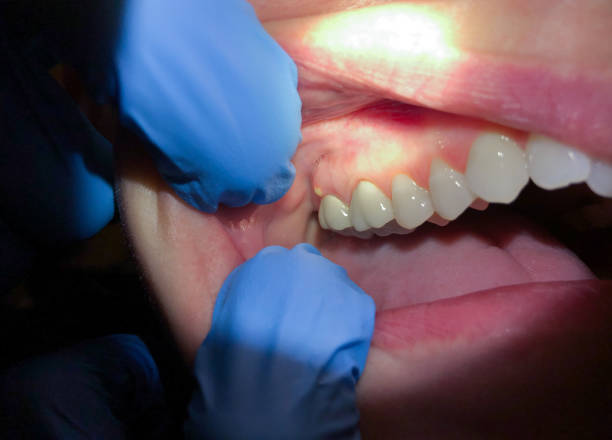 Best Weekend Emergency Dentist in Lowell, AR
