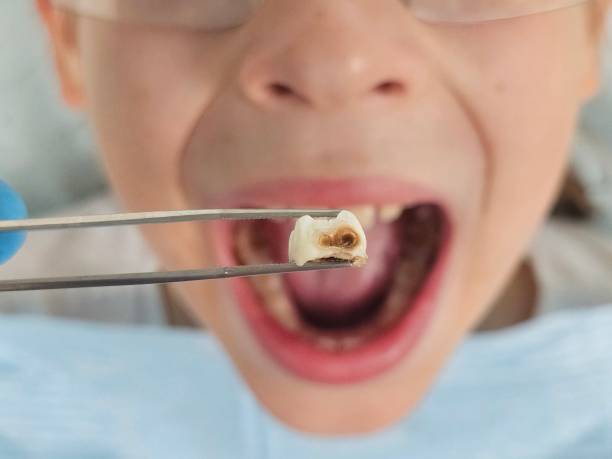 Best Emergency Broken Tooth Repair in Lowell, AR